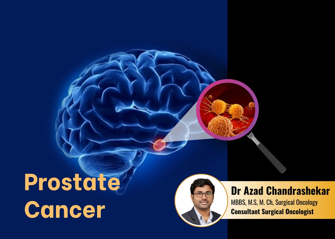 Best Brain-Cancer treatment in Hyderabad